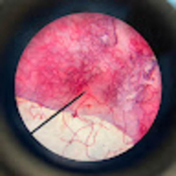 Meet your Posher, Addie - Picture 1 of 1